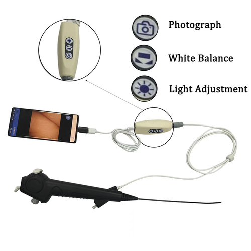 膀胱镜+USB图像板+手机